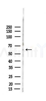 DBH Antibody - Western blot analysis of lysates from Rat testis, using DBH Antibody at 1/1000 dilution.