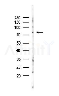 PAK4 Antibody - Western blot analysis of lysates from PC12 cells(LPS 4h treatment), using PAK4 Antibody at 1/1000 dilution.