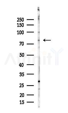 PAK4 Antibody - Western blot analysis of lysates from Rat brain, using PAK4 Antibody at 1/1000 dilution.