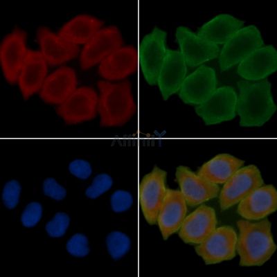 USO1 Antibody - DF7086 staining Hela cells(30min of UV treatment) by IF/ICC.