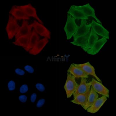CPT2 Antibody - DF7089 staining Hela cells(30min of UV treatment) by IF/ICC.