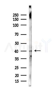 CTGF Antibody - Western blot analysis of lysates from Rat brain, using CTGF Antibody at 1/1000 dilution.