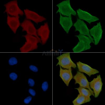 CX3CR1 Antibody - DF7096 staining Hela cells(30min of UV treatment) by IF/ICC.