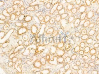 DRD1 Antibody - DF7097 at 1/100 staining human normal kidney tissue by IHC-P.