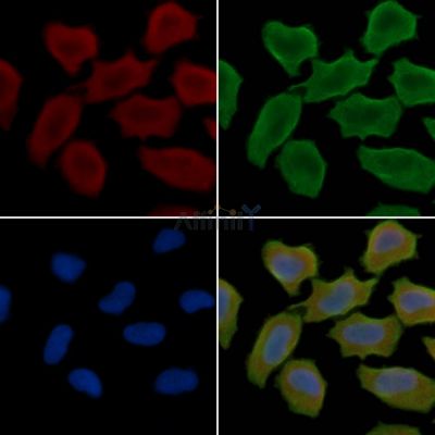 EDNRB Antibody - DF7104 staining Hela cells(30min of UV treatment) by IF/ICC.