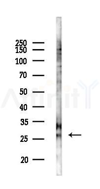 IGFBP1 Antibody - Western blot analysis of lysates from COLO205 cells(UV 30min treatment), using IGFBP1 Antibody at 1/1000 dilution.