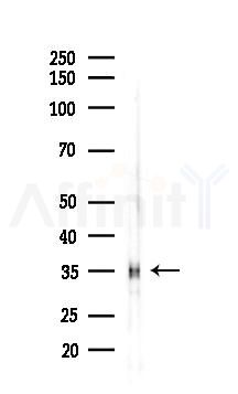 IL-2RA/CD25 Antibody - Western blot analysis of lysates from Hela cells(starvation 24h treatment), using IL-2RA/CD25 Antibody at 1/1000 dilution.