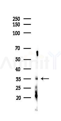 IL-2RA/CD25 Antibody - Western blot analysis of lysates from K562 cells(heat-shock 45min treatment), using IL-2RA/CD25 Antibody at 1/1000 dilution.