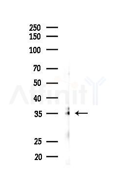 IL-2RA/CD25 Antibody - Western blot analysis of lysates from K562 cells(UV 30min treatment), using IL-2RA/CD25 Antibody at 1/1000 dilution.