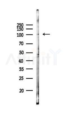 Leptin Receptor Antibody - Western blot analysis of lysates from Hela cells(starvation 24h treatment), using Leptin Receptor Antibody at 1/1000 dilution.