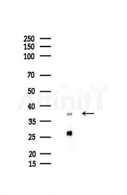 LRPAP1 Antibody - Western blot analysis of lysates from B16F10-LUC cells(starvation 24h treatment), using LRPAP1 Antibody at 1/1000 dilution.