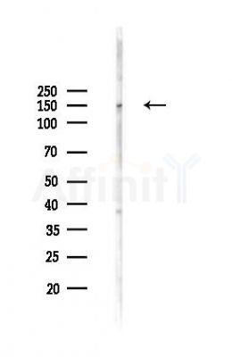 RAD50 Antibody - Western blot analysis of lysates from Mouse testis, using RAD50 Antibody at 1/1000 dilution.