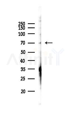 HNF1A Antibody - Western blot analysis of lysates from Hela cells(starvation 24h treatment), using HNF1A Antibody at 1/1000 dilution.