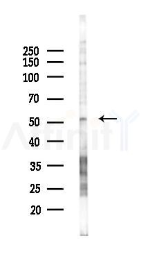 PACAP receptor Antibody - Western blot analysis of lysates from K562 cells(starvation 24h treatment), using PACAP receptor Antibody at 1/1000 dilution.