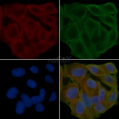 CSF2RA Antibody - DF7224 staining Hela cells(24h of starvation treatment) by IF/ICC.