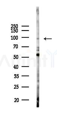 DNMT3A Antibody - Western blot analysis of lysates from COLO205 cells(UV 30min treatment), using DNMT3A Antibody at 1/1000 dilution.