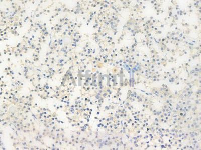 PAK1 Antibody - DF7247 at 1/100 staining human pituitary adenoma by IHC-P.