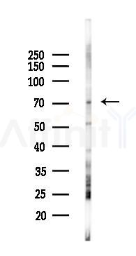 RACGAP1 Antibody - Western blot analysis of lysates from K562 cells(starvation 24h treatment), using RACGAP1 Antibody at 1/1000 dilution.