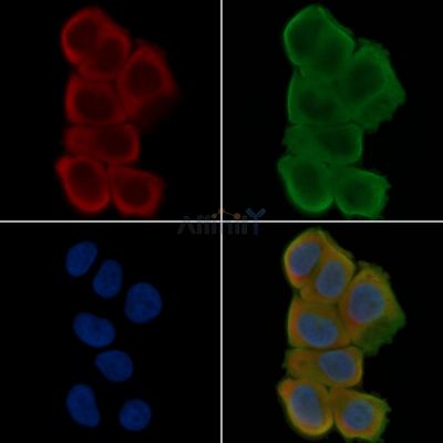 EFNA1 Antibody - DF7284 staining Hela cells(30min of UV treatment) by IF/ICC.