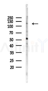 GM130 Antibody - Western blot analysis of lysates from Rat brain, using GM130 Antibody at 1/1000 dilution.