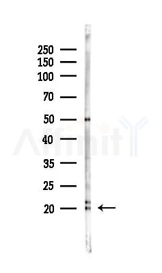 NPC2 Antibody - Western blot analysis of lysates from PC12 cells(LPS 4h treatment), using NPC2 Antibody at 1/1000 dilution.