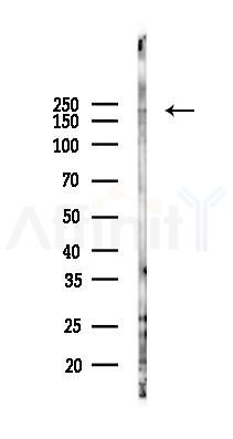 MERTK Antibody - Western blot analysis of lysates from HUVEC cells(starvation 24h treatment), using MERTK Antibody at 1/1000 dilution.