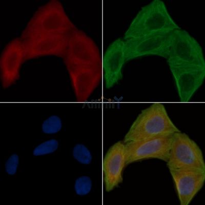 ERAB Antibody - DF7347 staining Hela cells(30min of UV treatment) by IF/ICC.