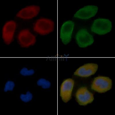 SULT2A1 Antibody - DF7371 staining Hela cells(30min of UV treatment) by IF/ICC.
