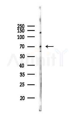 PRDM14 Antibody - Western blot analysis of lysates from Hela cells(starvation 24h treatment), using PRDM14 Antibody at 1/1000 dilution.