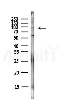 ICAM1 Antibody - Western blot analysis of lysates from PC12 cells(LPS,4h treatment), using ICAM1 Antibody at 1/1000 dilution.