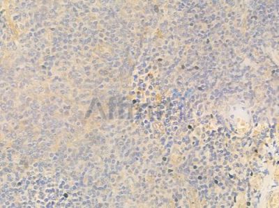LC3A Antibody - DF7421 at 1/100 staining human normal tonsil tissue by IHC-P.
