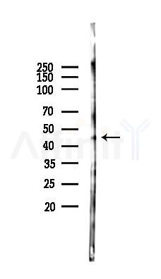 FH Antibody - Western blot analysis of lysates from EC304 cells(starvation 24h treatment), using FH Antibody at 1/1000 dilution.