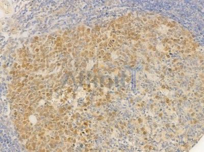 Phospho-ATR (Ser428) Antibody - DF7512 at 1/100 staining human normal tonsil tissue by IHC-P.