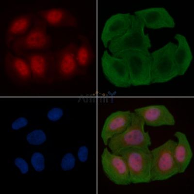 Phospho-ATR (Ser428) Antibody - DF7512 staining Hela cells(30min of UV treatment) by IF/ICC.