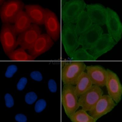 USP7 Antibody - DF7529 staining Hela cells(30min of UV treatment) by IF/ICC.
