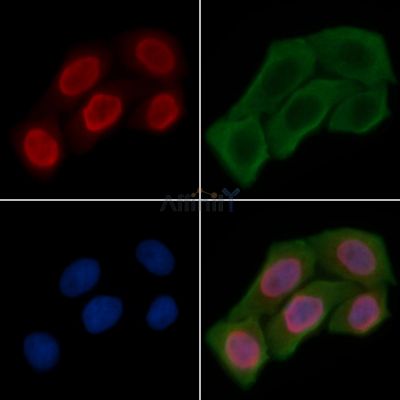 DDX5 Antibody - DF7539 staining Hela cells(30min of UV treatment) by IF/ICC.