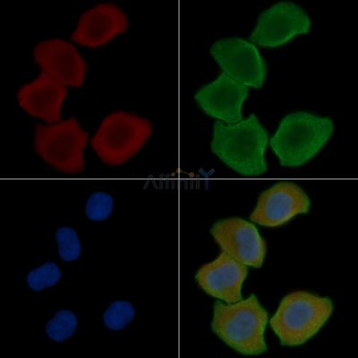 Catalase Antibody - DF7545 staining Hela cells(30min of UV treatment) by IF/ICC.