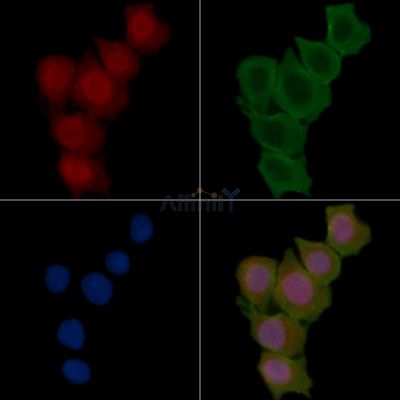 Phospho-PKC epsilon (Ser729) Antibody - DF7573 staining Hela cells(30min of UV treatment) by IF/ICC.