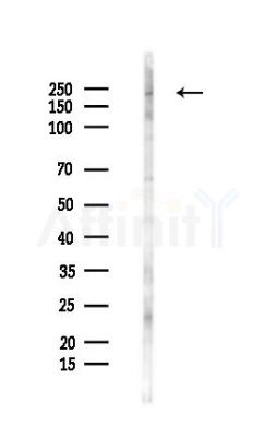 BRG1 Antibody - Western blot analysis of lysates from B16F10-LUC cells(starvation 24h treatment), using BRG1 Antibody at 1/1000 dilution.