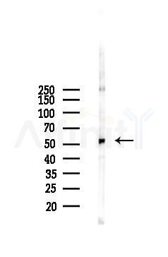 CCNA2 Antibody - Western blot analysis of lysates from HUVEC cells(starvation 24h treatment), using CCNA2 Antibody at 1/1000 dilution.