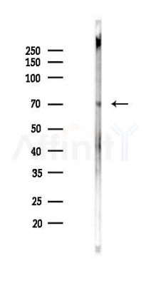 IL-1R alpha /CD121 alpha Antibody - Western blot analysis of lysates from Rat brain, using IL-1R alpha /CD121 alpha Antibody at 1/1000 dilution.