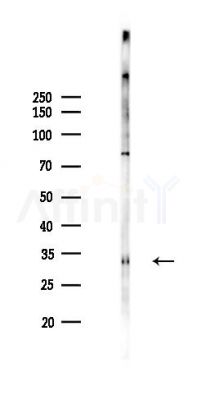 AurB/C Antibody - Western blot analysis of lysates from PC12 cells(LPS 4h treatment), using AurB/C Antibody at 1/1000 dilution.