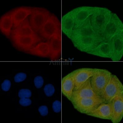 NEFM Antibody - DF7673 staining Hela cells(30min of UV treatment) by IF/ICC.