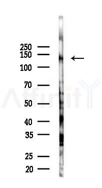 IRS4 Antibody - Western blot analysis of lysates from COLO205 cells(starvation 24h treatment), using IRS4 Antibody at 1/1000 dilution.