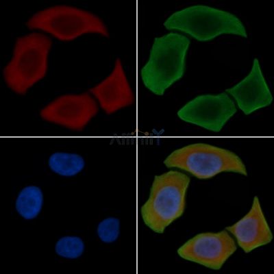 Nestin Antibody - DF7754 staining Hela cells(30min of UV treatment) by IF/ICC.
