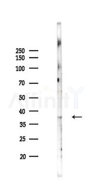 IGFBP2 Antibody - Western blot analysis of lysates from PC12 cells(LPS 4h treatment), using IGFBP2 Antibody at 1/1000 dilution.
