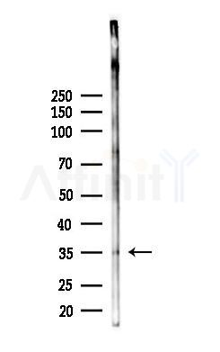 SIAH2 Antibody - Western blot analysis of lysates from HUVEC cells(starvation 24h treatment), using SIAH2 Antibody at 1/1000 dilution.
