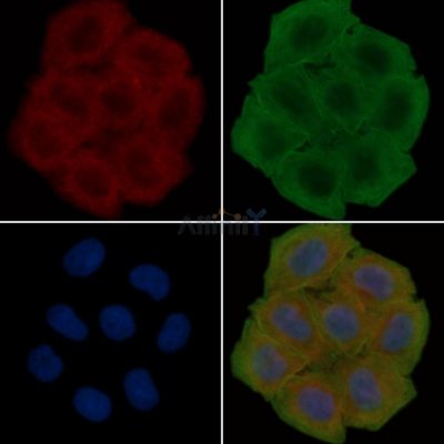 NODAL Antibody - DF7791 staining Hela cells(30min of UV treatment) by IF/ICC.