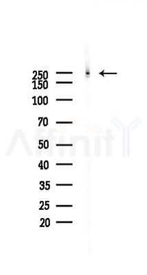 GCN2 Antibody - Western blot analysis of lysates from Hela cells(starvation 24h treatment), using GCN2 Antibody at 1/1000 dilution.