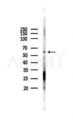 NUR77 Antibody - Western blot analysis of lysates from EC304 cells(starvation 24h treatment), using NUR77 Antibody at 1/1000 dilution.